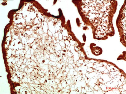 HP-1Alpha Monoclonal Antibody (2G2)