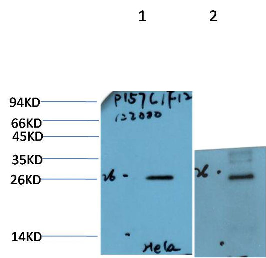 Bcl-2 Monoclonal Antibody (1F12）