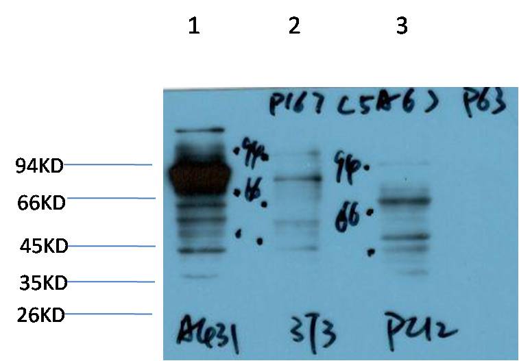P63-Alpha Monoclonal Antibody (5A6）