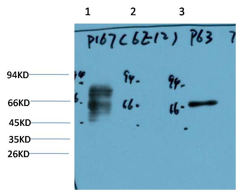 P63-Alpha Monoclonal Antibody (6E12）