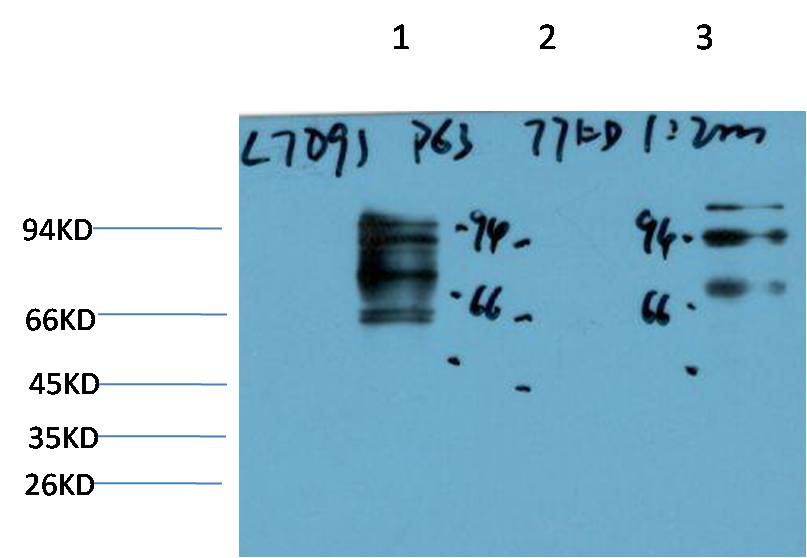 P63-Alpha Monoclonal Antibody (7D9）