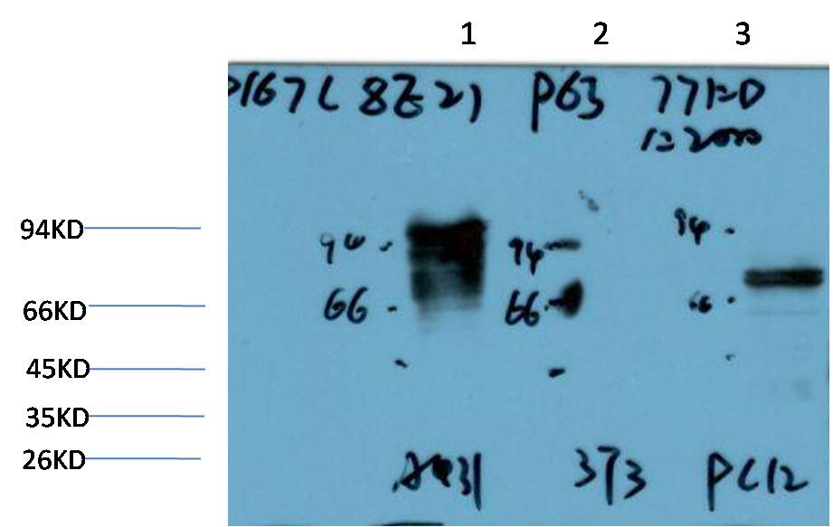 P63-Alpha Monoclonal Antibody (8E2）