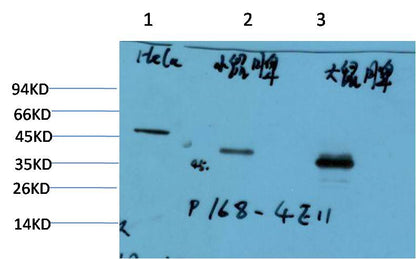 PAX-5 Monoclonal Antibody (4E11)