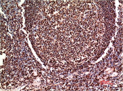 PAX-5 Monoclonal Antibody (4E11)