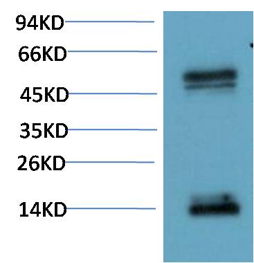 PAX-8 Monoclonal Antibody (3H11)