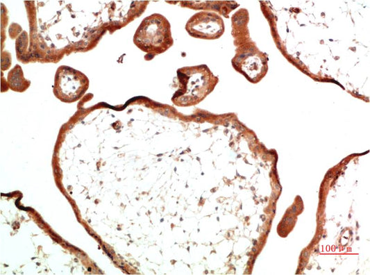 TGFBetaReceptor III Monoclonal Antibody (10E10)