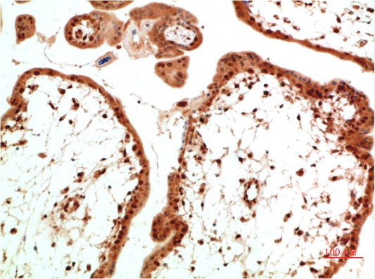 TGFBetaReceptor III Monoclonal Antibody (2B7)