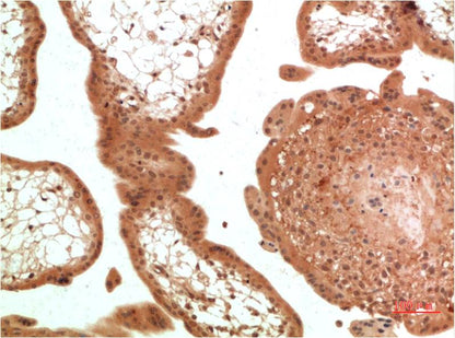 TGFBetaReceptor III Monoclonal Antibody (5D11)