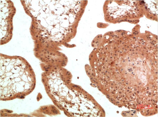 TGFBetaReceptor III Monoclonal Antibody (5D11)