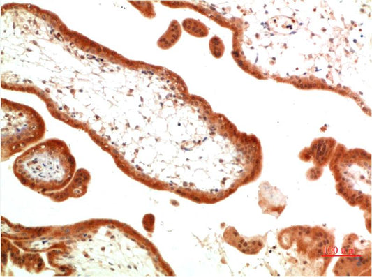 TGFBetaReceptor III Monoclonal Antibody (7G11)