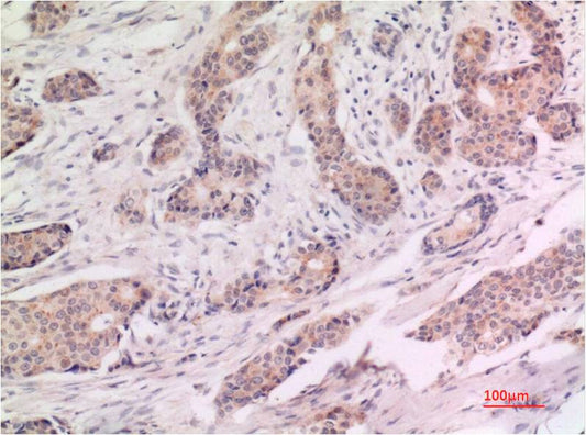 P53 Monoclonal Antibody (2D2)