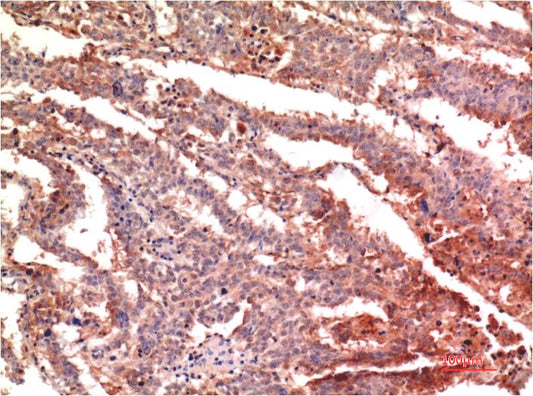 P53 (Di Methyl Lys370)Monoclonal Antibody (1G8)