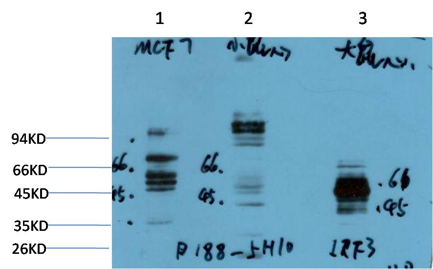 IRF3 Monoclonal Antibody (5H10)