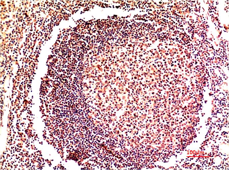 IRF3 Monoclonal Antibody (5H10)