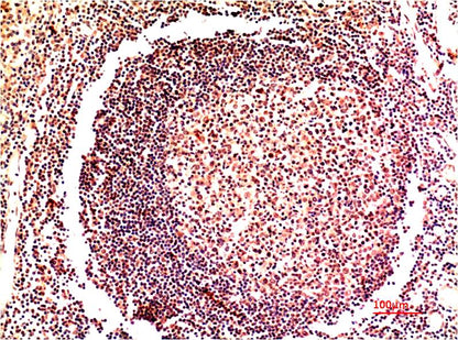 IRF3 Monoclonal Antibody (5H10)