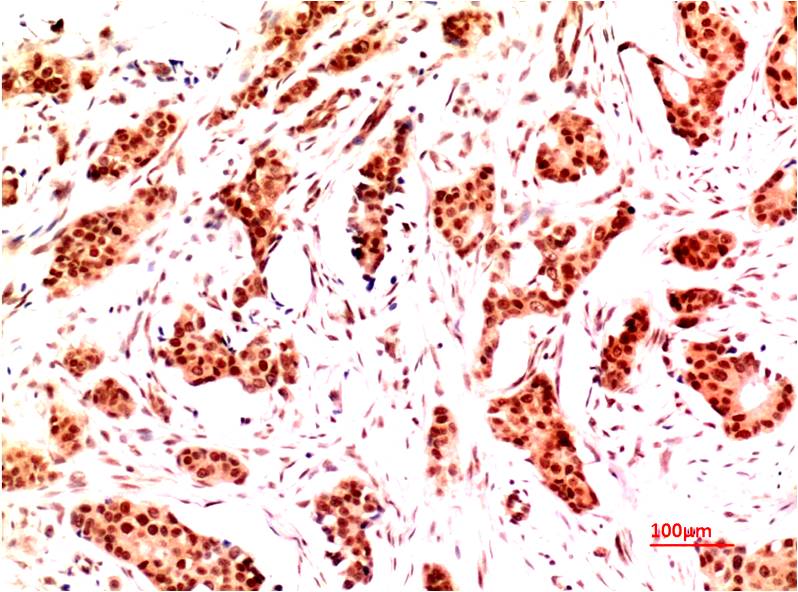 NFAT5 Monoclonal Antibody (1D6)