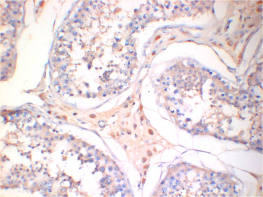 AMPK Gamma1 Monoclonal Antibody (5A1)
