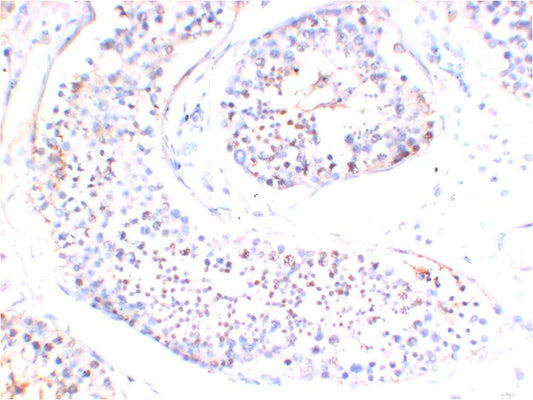 AMPK Gamma1 Monoclonal Antibody (5H5)