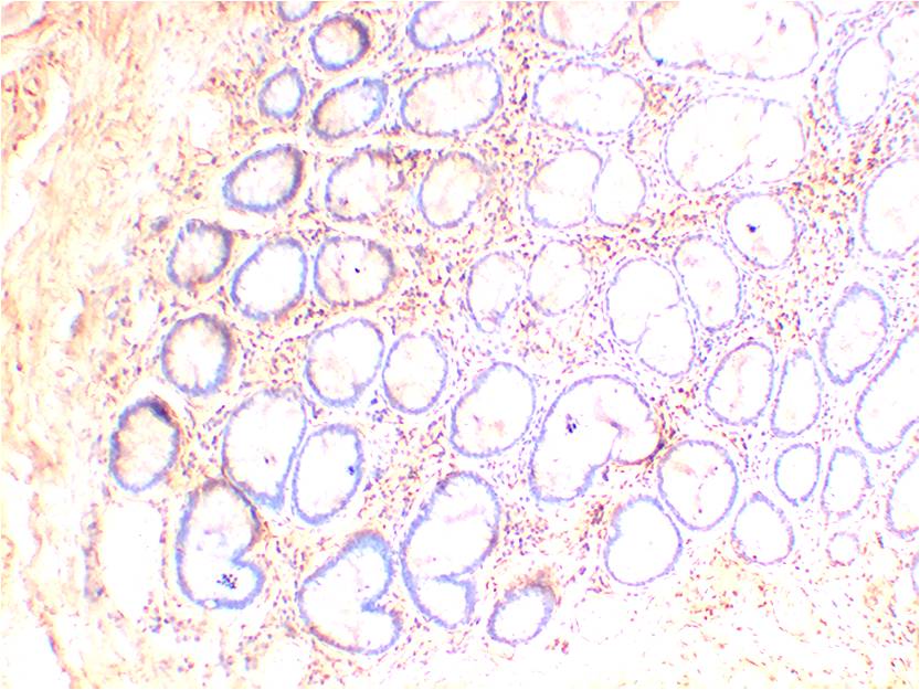 AMPKBeta1 Monoclonal Antibody (5D8)