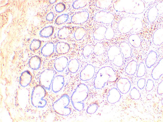 AMPKBeta1 Monoclonal Antibody (5D8)