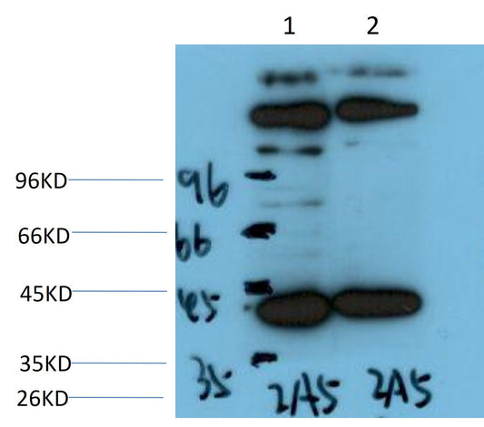 IkB Alpha Monoclonal Antibody (2A5)