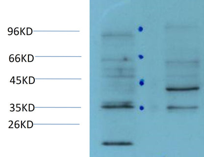 CDX-2 Monoclonal Antibody (6D9)