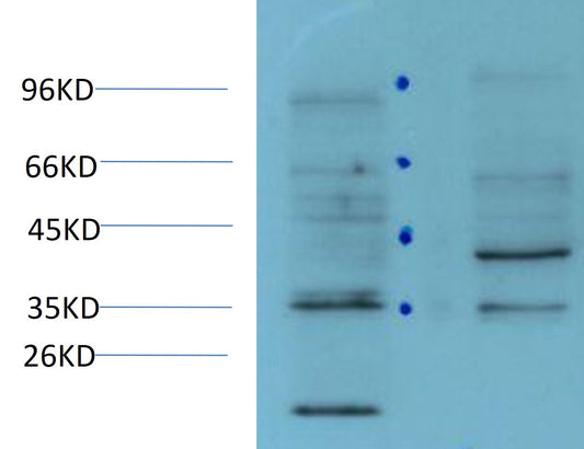 CDX-2 Monoclonal Antibody (6D9)