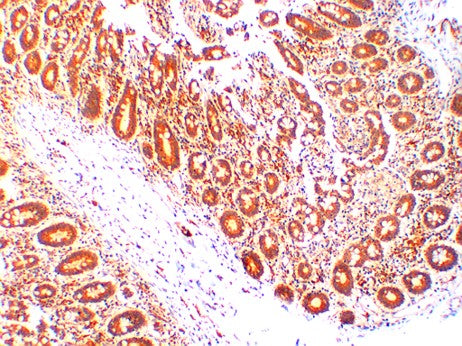 CDX-2 Monoclonal Antibody (6D9)