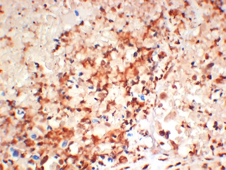 Myd88 Monoclonal Antibody (2H12)