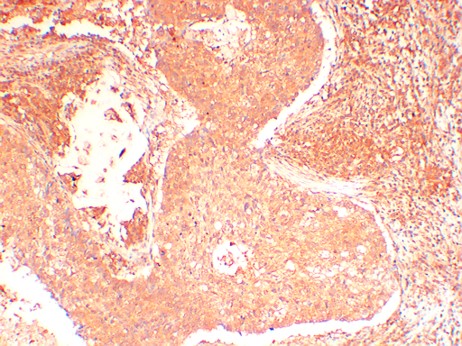 JAK2 Monoclonal Antibody (6D6)