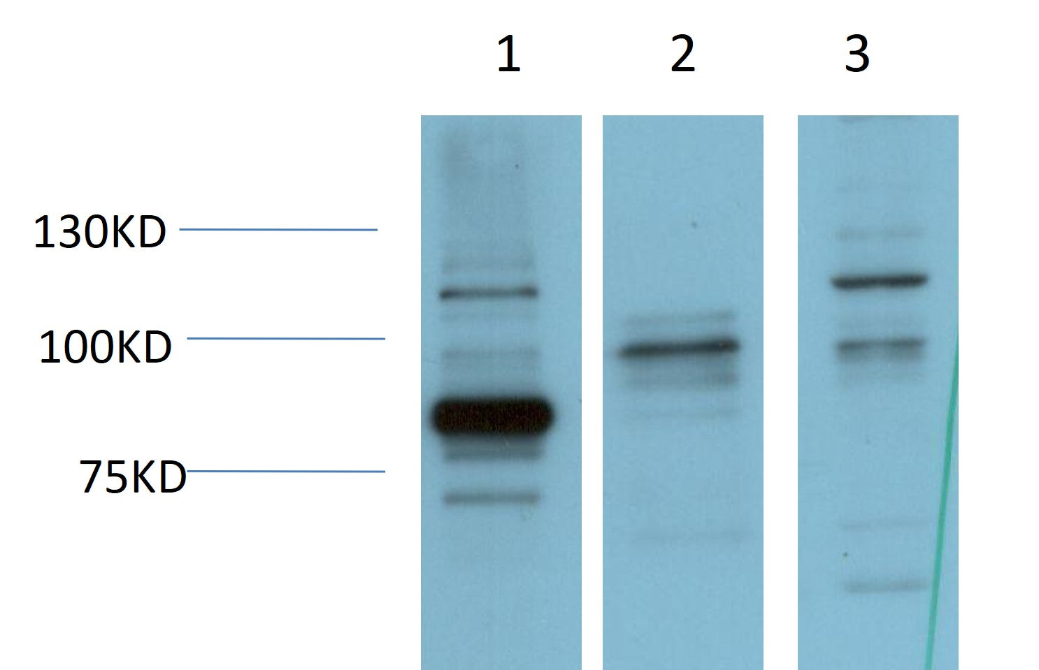 ERK5 Monoclonal Antibody (4G5)