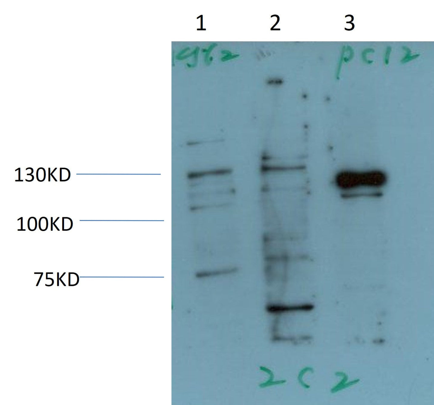 JAK2 Monoclonal Antibody (2C2)