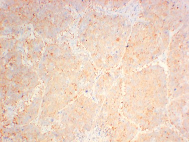 JAK2 Monoclonal Antibody (2C2)