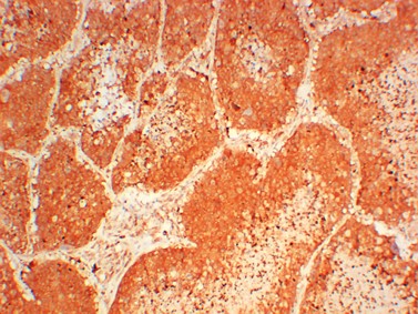 JAK3 Monoclonal Antibody (6B5)