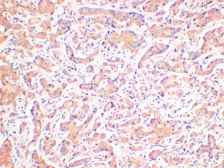 JNK2 Monoclonal Antibody (4D2)