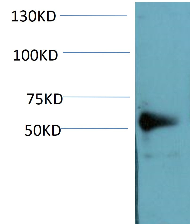 NF-kB P50 Monoclonal Antibody (5D2)