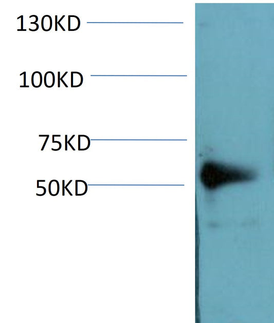 NF-kB P50 Monoclonal Antibody (5D2)