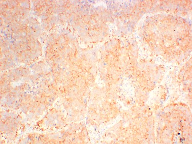 JAK2 Monoclonal Antibody (2F6)