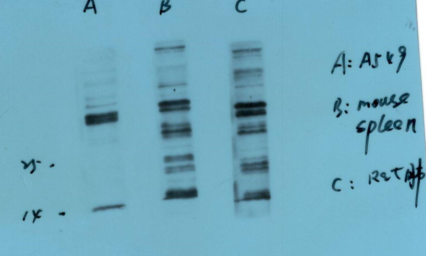 S100 A8+A9 Complex Monoclonal Antibody (11C12)