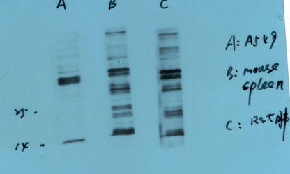 S100 A8+A9 Complex Monoclonal Antibody (11C12)