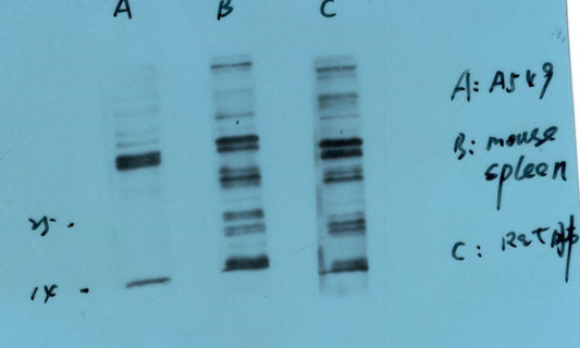 S100 A8+A9 Complex Monoclonal Antibody (11C12)