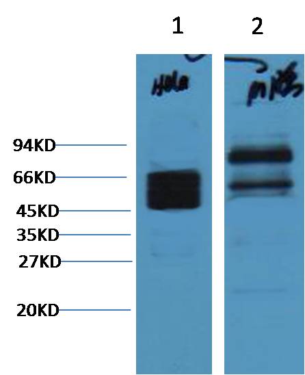 CK8 Monoclonal Antibody (8G8)
