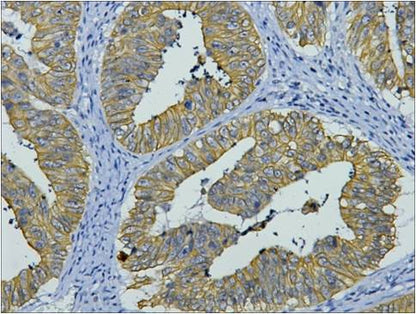 CK8 Monoclonal Antibody (8G8)