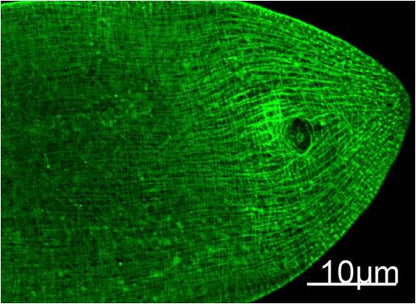 Myosin Heavy Chain Monoclonal Antibody (11C2)