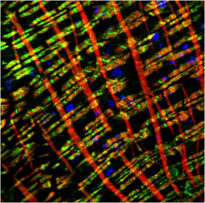 Myosin Heavy Chain Monoclonal Antibody (11C2)