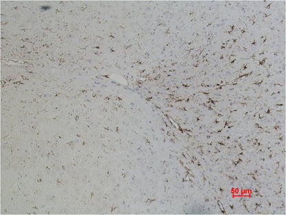 GFAP Monoclonal Antibody (5C8)