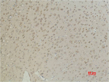 Aquaporin 4 Monoclonal Antibody (4H1)