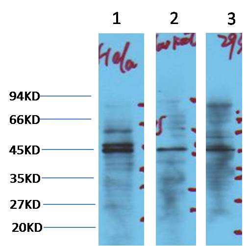 NSE Monoclonal Antibody (13E2)