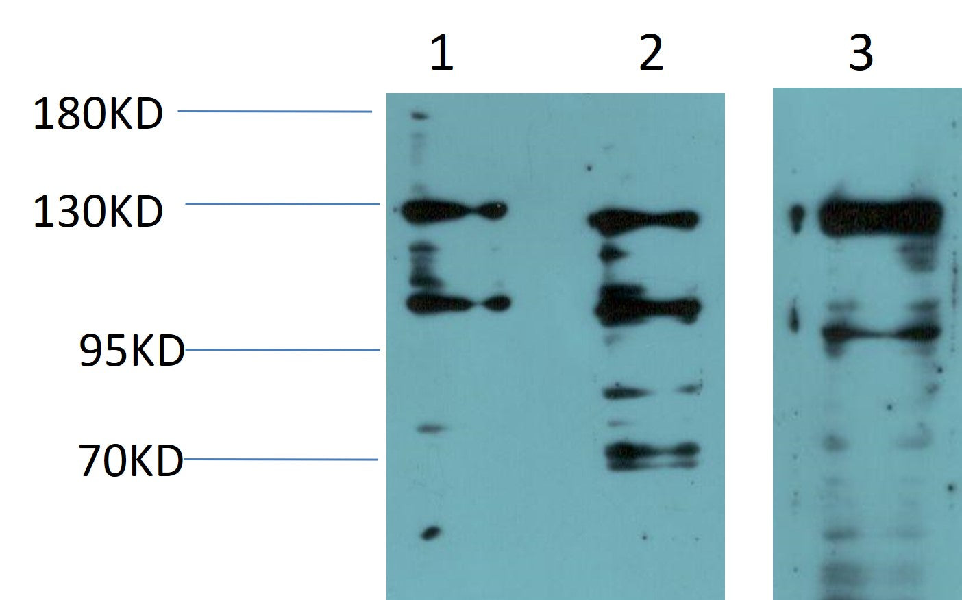 JAK1 Monoclonal Antibody (3F12)