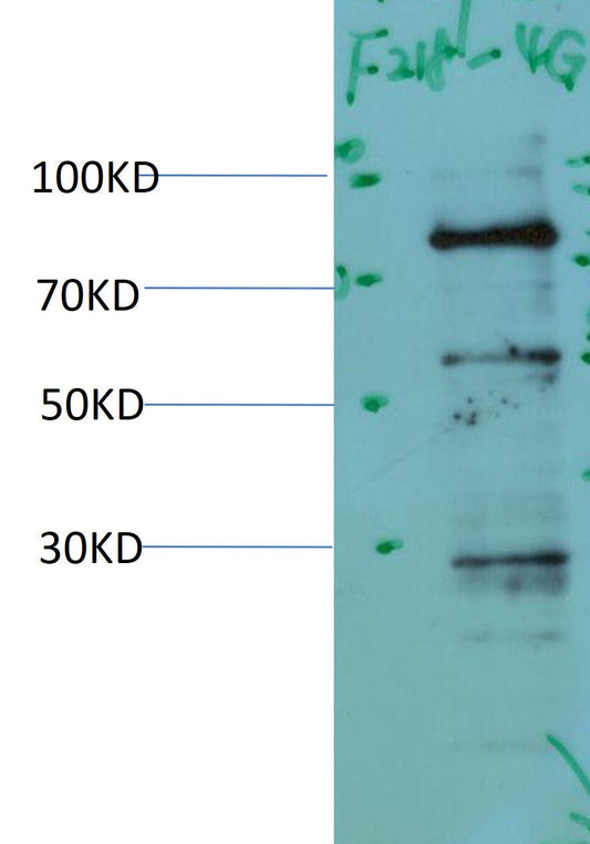 PI3K P85Alpha Monoclonal Antibody (4G2)